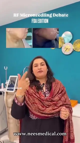 NEES Medical Instagram reel 5